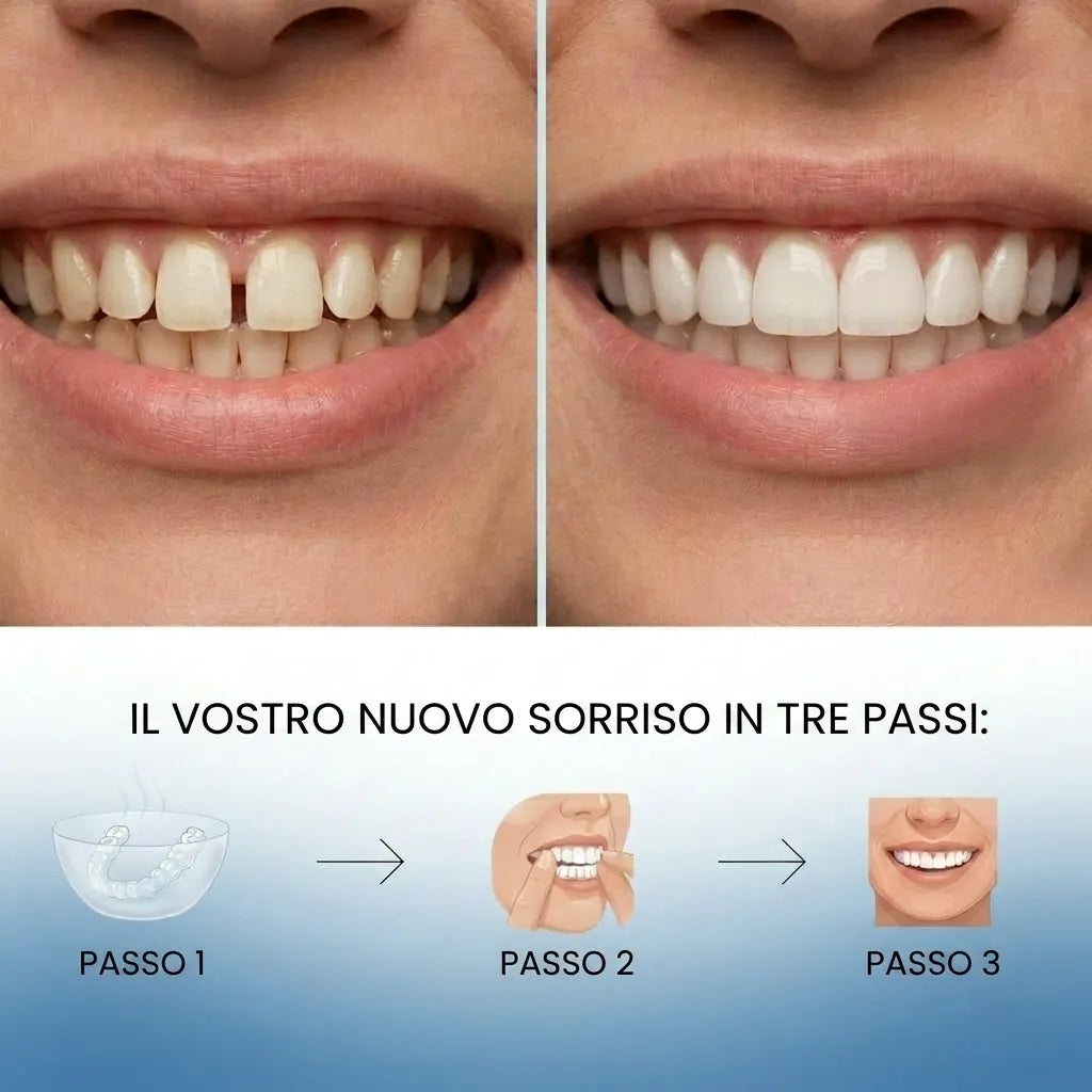 Faccette Adattabili e Rimovibili